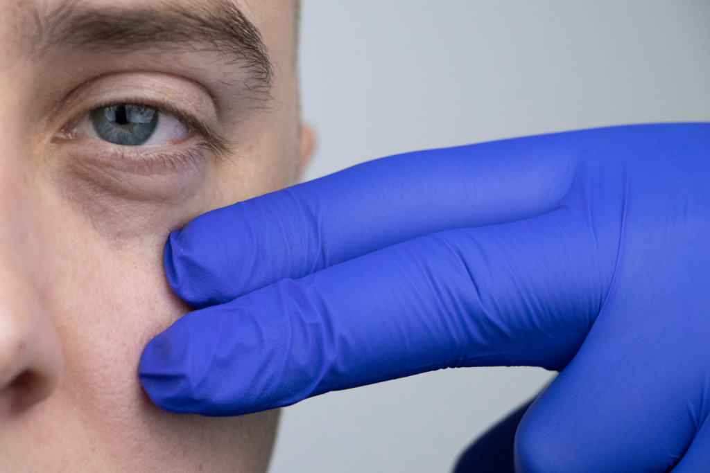 quitar bolsas de los ojos