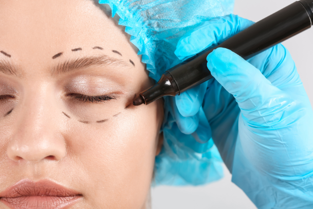 blefaroplastia lanzarote