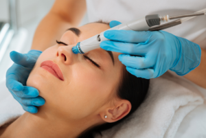 hydrafacial lanzarote