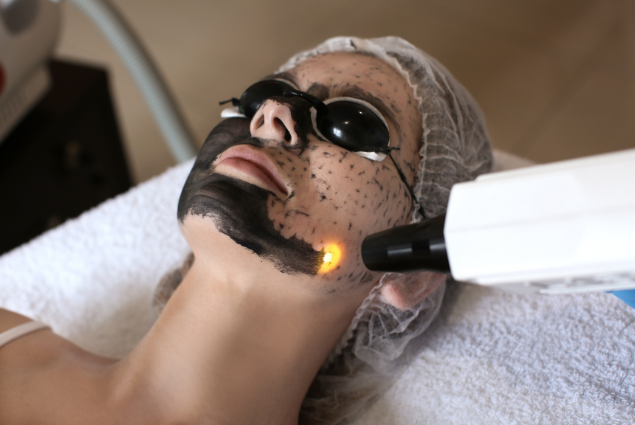 carbon peel lanzarote