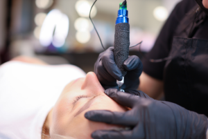 skinpen lanzarote maive